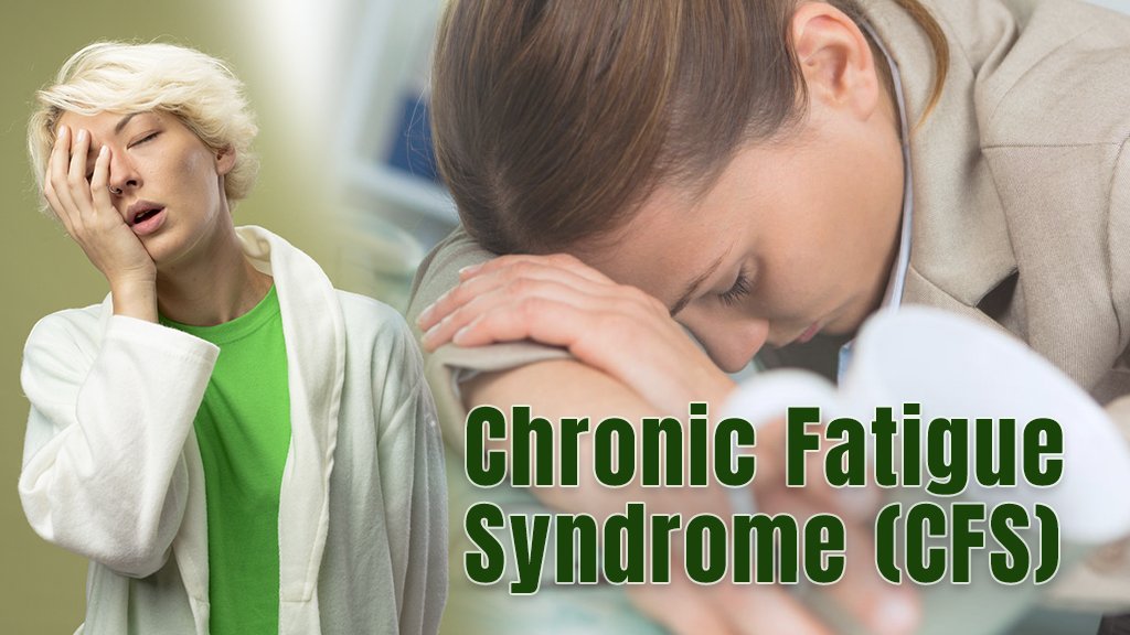 About Chronic Fatigue Syndrome CFS